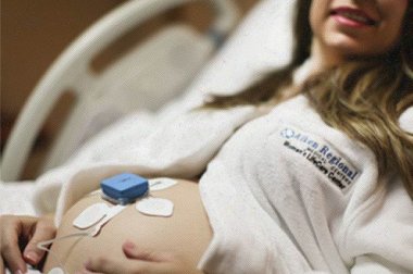 Wireless Fetal Monitors